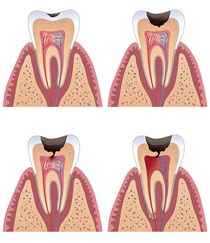 Endodontologie